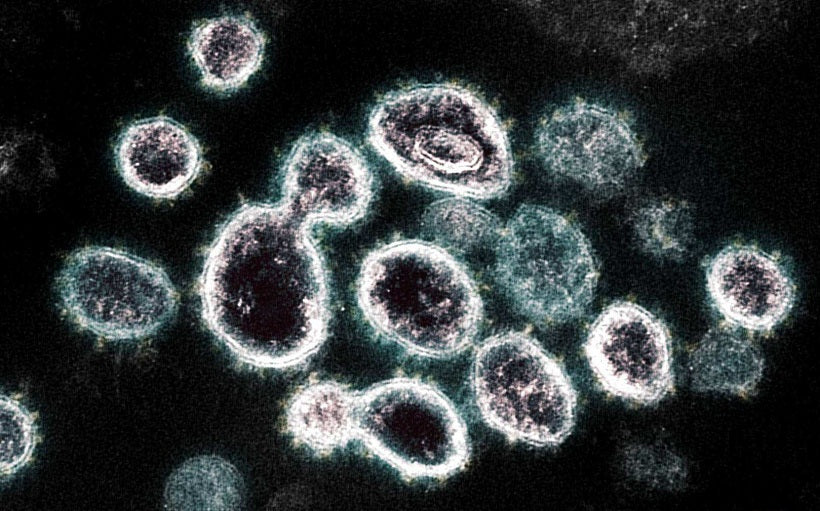 covid 19 virus